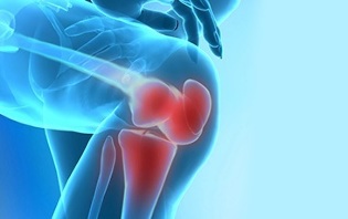 comment se manifeste l'arthrose du genou